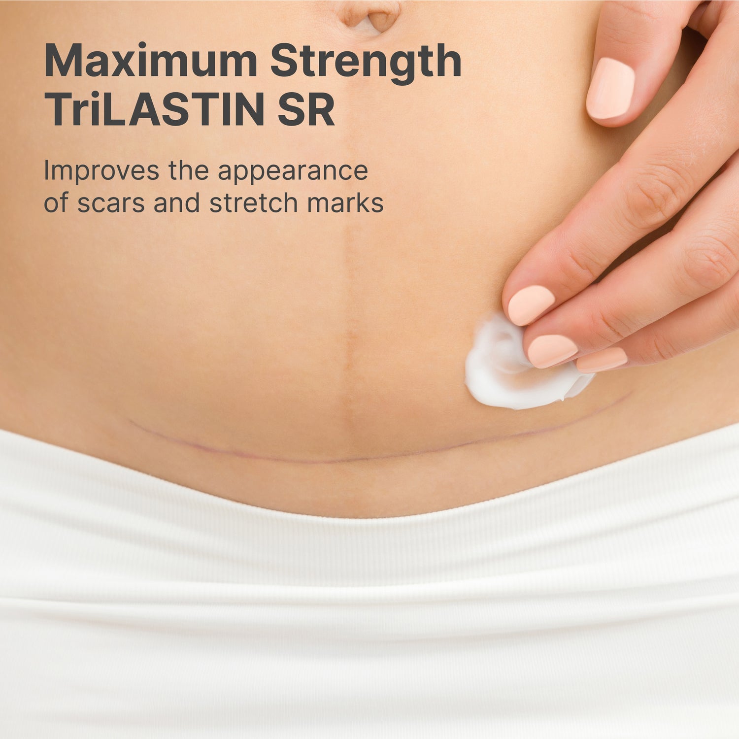 TriLASTIN Stretch Mark Treatment Routine - 2 Month Supply - TriLASTIN