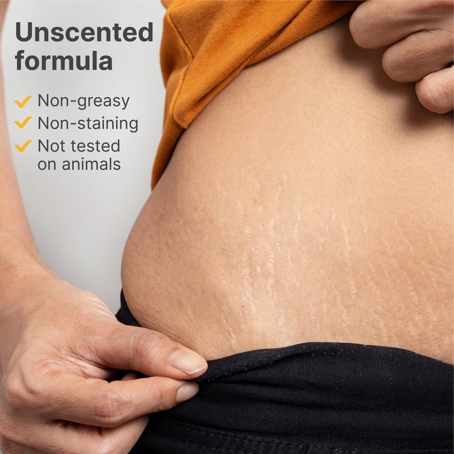 TriLASTIN Stretch Mark Treatment Routine - 2 Month Supply - TriLASTIN