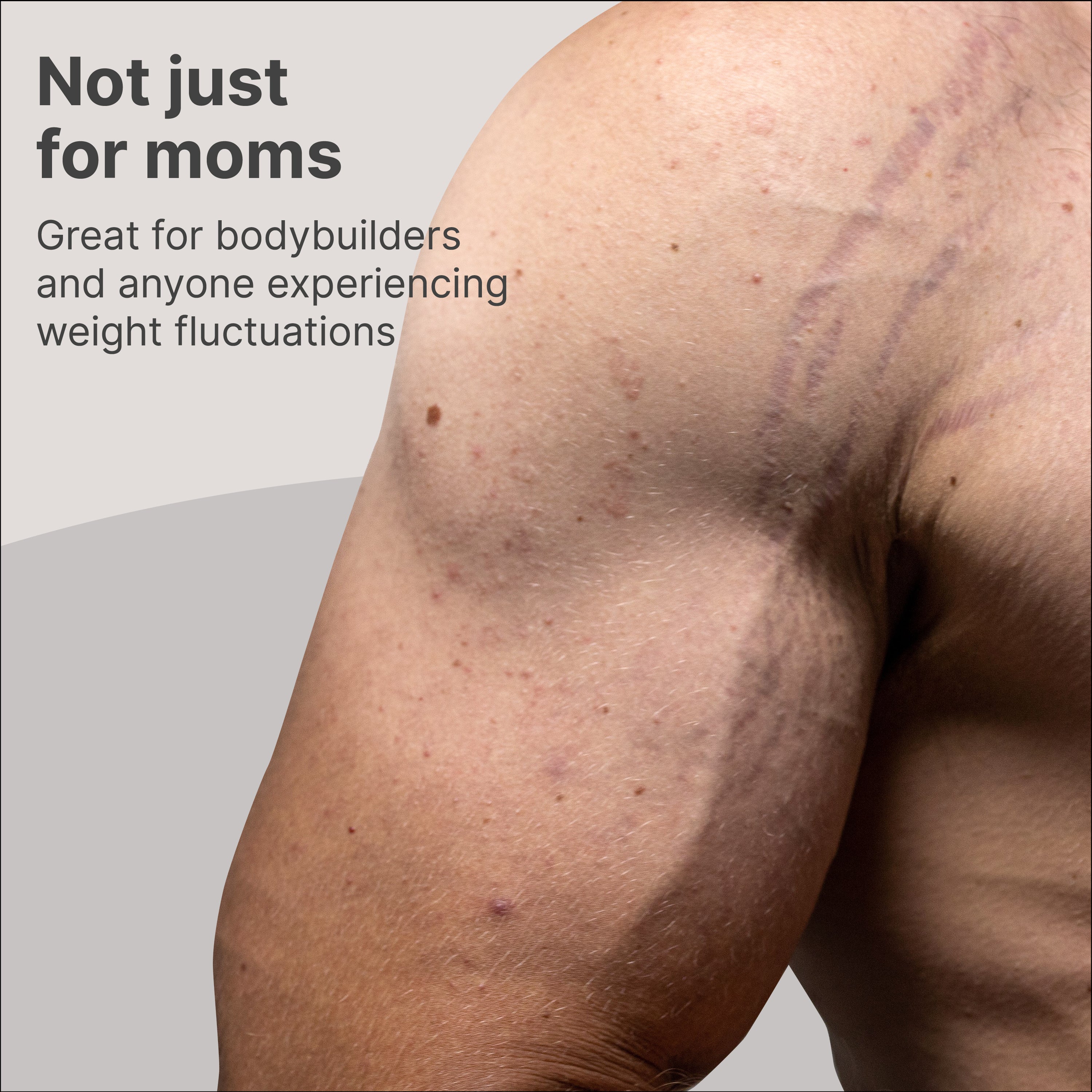 TriLASTIN Maternity Stretch Mark Prevention Cream - Trimester 3-pack - TriLASTIN