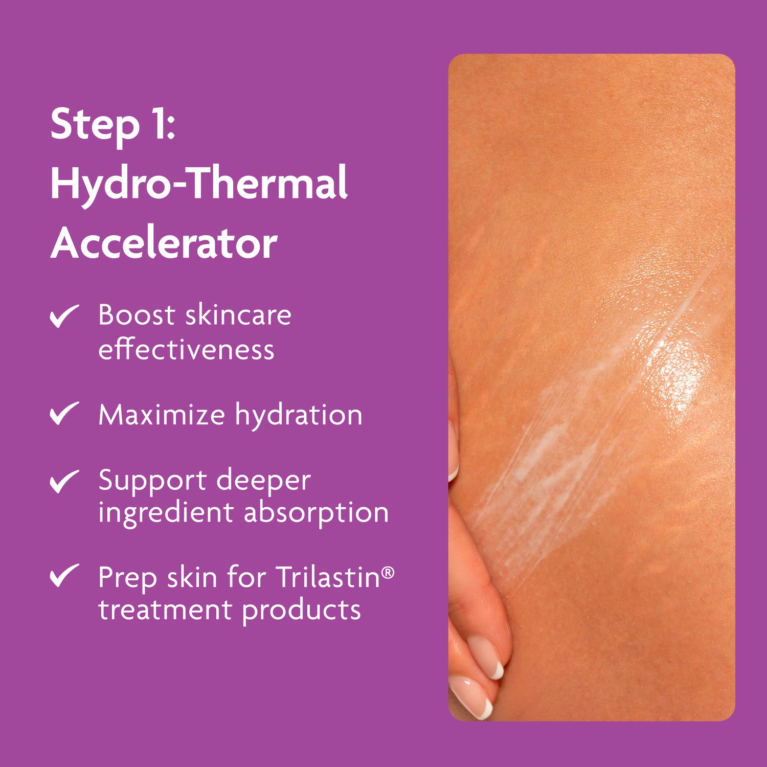 Stretch Mark Treatment Routine