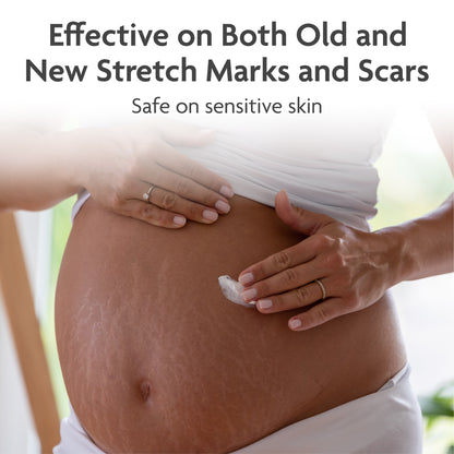 TriLASTIN Intensive Stretch Mark Cream