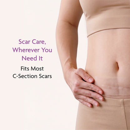 Silicone Scar Sheets